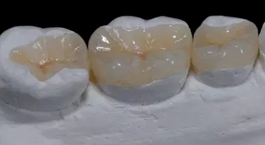 Teeth 2